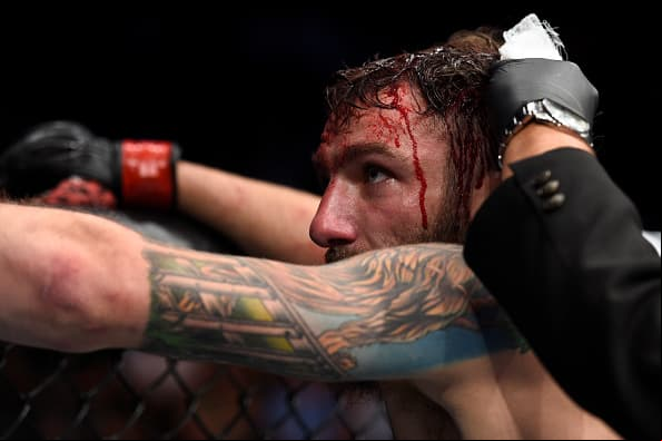 OKLAHOMA CITY, OK - JUNE 25: Michael Chiesa reacts after his submission loss to Kevin Lee in their lightweight bout during the UFC Fight Night event at the Chesapeake Energy Arena on June 25, 2017 in Oklahoma City, Oklahoma. (Photo by Brandon Magnus/Zuffa LLC/Zuffa LLC via Getty Images)